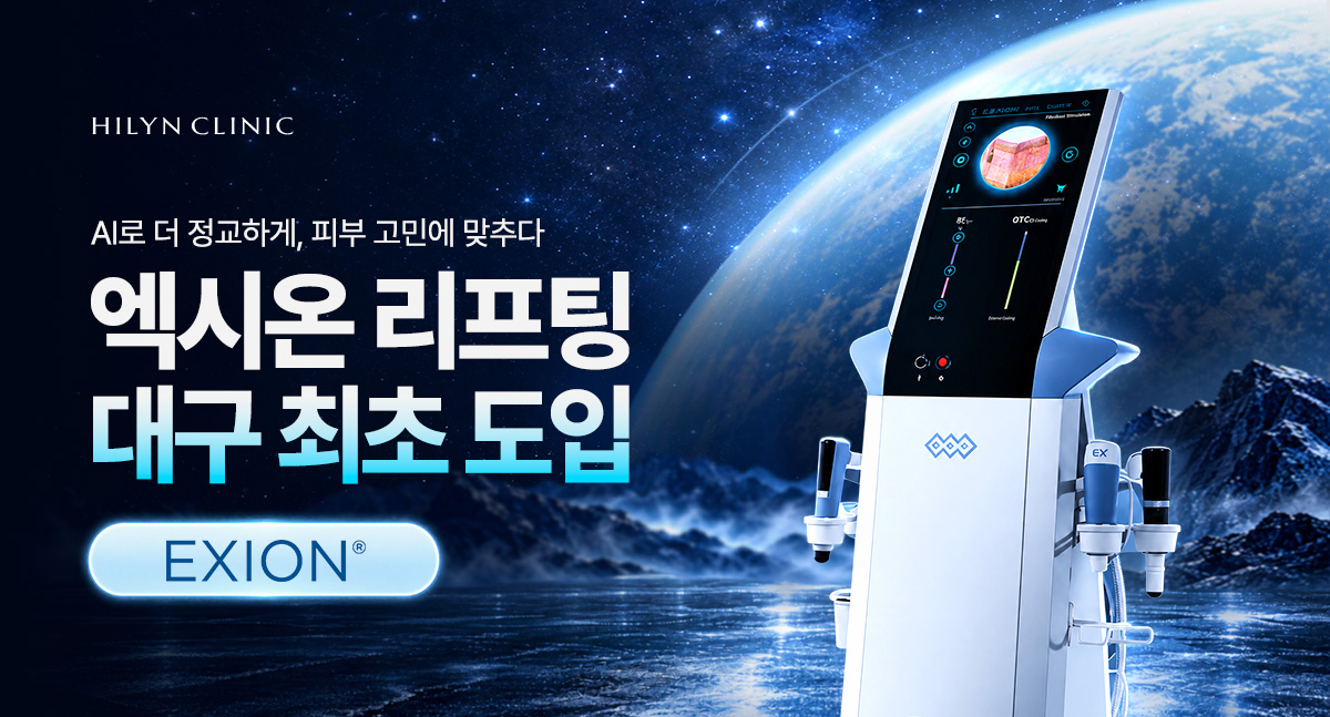 엑시온 사전예약 혜택